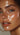 Microneedling with Salmon DNA: The Skin Regeneration Treatment Everyone is Talking About