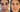 What Is Facial Harmonization? The Brazilian Approach to Proportion