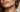 Jawline Filler NYC: Filler, Threads, or Neither? - DR. CRIS STUDIO