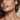 Jawline Filler NYC: Filler, Threads, or Neither? - DR. CRIS STUDIO