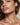Jawline Filler NYC: Filler, Threads, or Neither? - DR. CRIS STUDIO