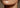 Non-Surgical Neck Lift in NYC: How I Compare Your Options - DR. CRIS STUDIO