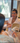 Why Exosomes Outperform Vampire Facials, PRP, and RF Microneedling for Anti-Aging