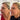 Lifting facial sin cirugía en Nueva York: tus opciones - DR. CRIS STUDIO