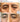 Under-Eye Filler in NYC: How Long It Lasts, Cost & Who It's Right For