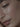 Woman gorgeous skin after Botox in Dr Cris Studio NYC