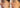 Best Non-Surgical Face Lift in NYC: What to Actually Look For - DR. CRIS STUDIO