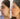 Before and after a a non surgical face lift done at Dr Cris Studio in midtown NYC