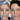 Sculptra vs Radiesse: Which Biostimulator Is Right for You? - DR. CRIS STUDIO