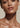 Non-Surgical Neck Lift NYC: How Biostimulators + PDO Threads Transform the Neck