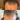 A before-and-after comparison of a man's thinning hair on his crown. The top panel labeled 'Before/antes' shows more visible scalp and sparse hair, while the bottom panel labeled 'After/Depos' shows fuller, darker hair.