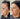 Before and after comparison  after Full face PDO threads of a woman's face with visible aging changes.