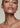 HIFU Skin Tightening Treatment | Non-Surgical Face or Neck Lift NYC - DR. CRIS STUDIO