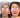 Before and after comparison of a woman's face  after full face balance treatment 