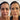 before and after face and neck biostimulator and full face balance 